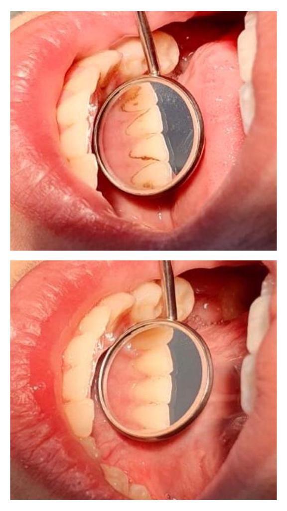 Imagine portofoliu 1