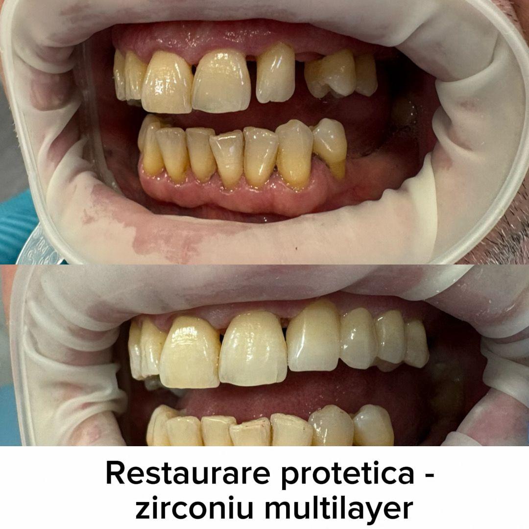 Imagine portofoliu 3