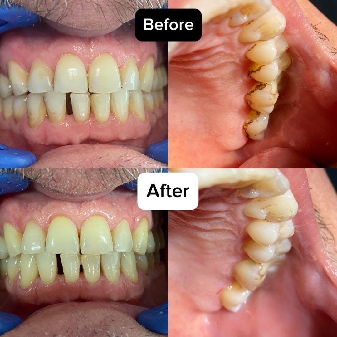 Imagine portofoliu 4